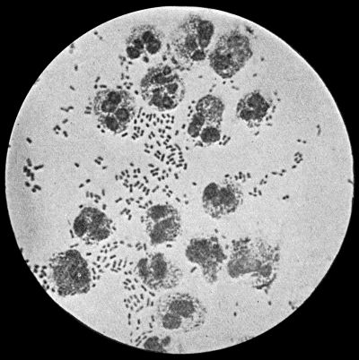 Fig. 4.—Bacillus coli communis in Urine, from a case of Cystitis.  1000 diam. Leishman's stain.
