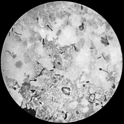 Fig. 26.—Bacillus of Tetanus from scraping of a wound of finger,  1000 diam. Basic fuchsin stain.