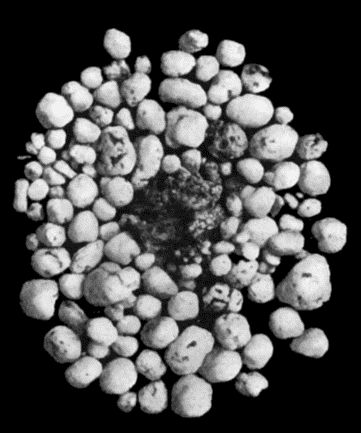 Fig. 168.—Multiple partially ossified Chondromas of Synovial Membrane, from Shoulder-joint, the seat of arthritis deformans, from a man t.35.