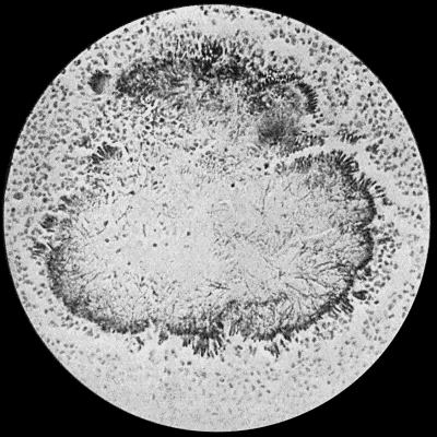 Fig. 30.—Section of Actinomycosis Colony in Pus from Abscess of Liver, showing filaments and clubs of streptothrix actinomyces.  400 diam. Gram's stain.